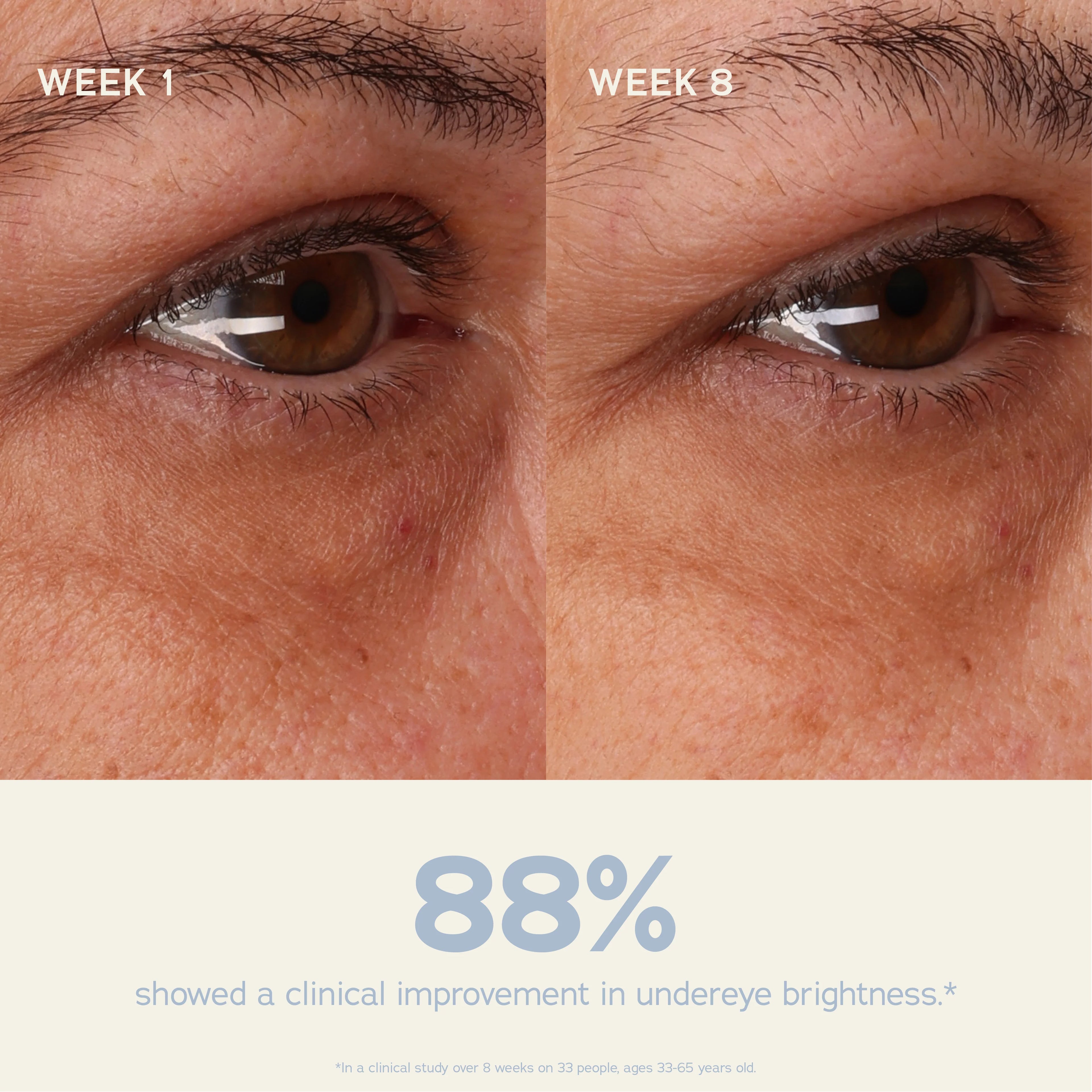 Vitality Eye Cream